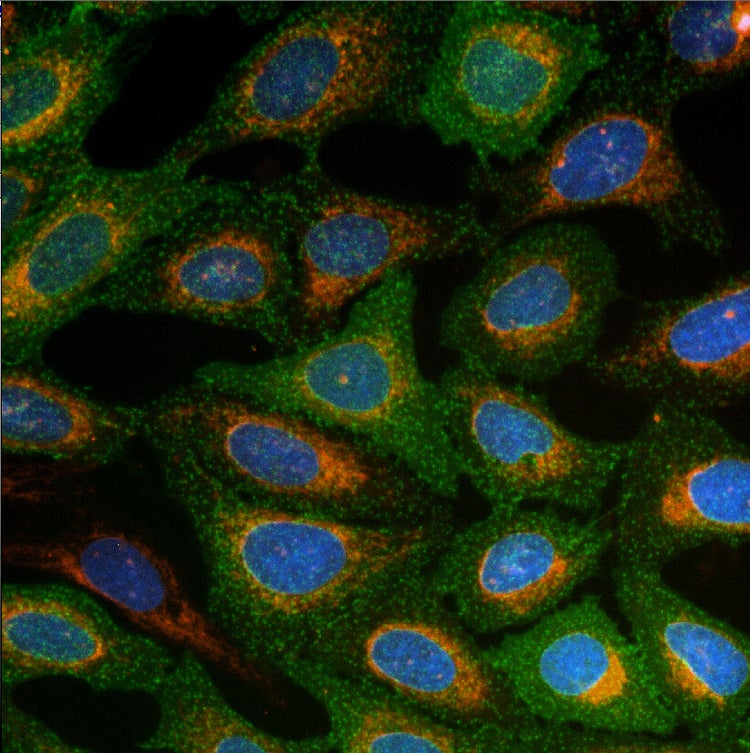 AgileOptix-Technologie für das ImageXpress Micro Confocal