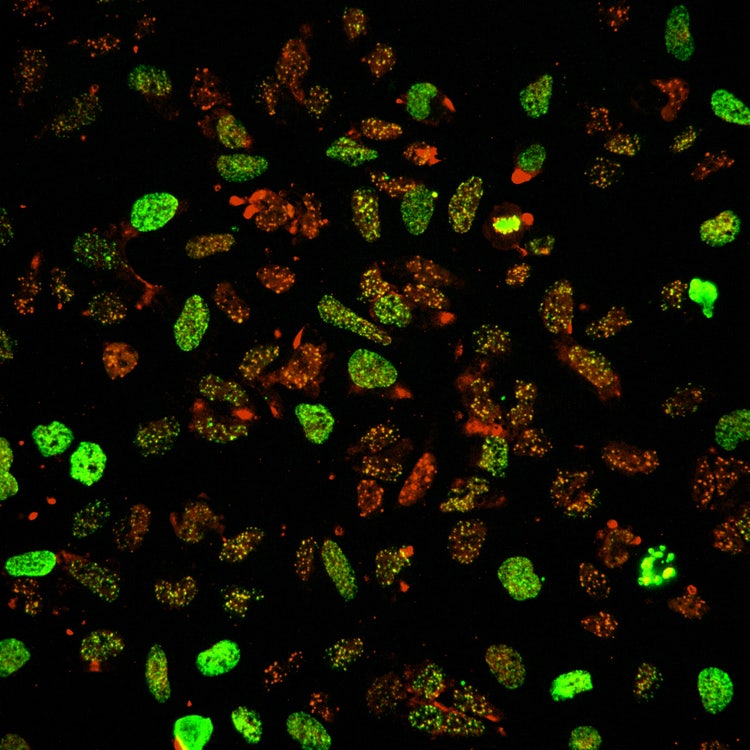Micro Confocal High-Content Imaging-Lösung