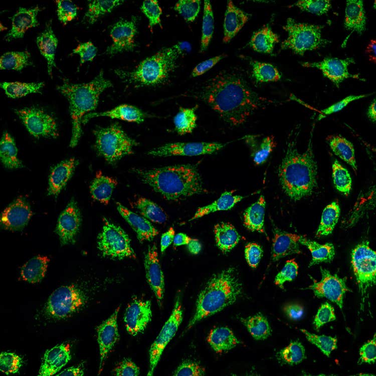 ImageXpress Micro Confocal Imaging System