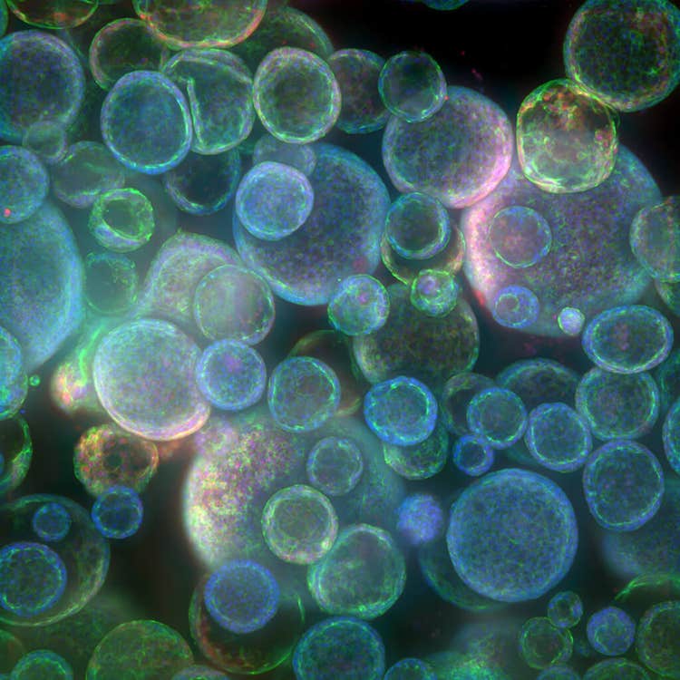Organoid-Abbildung aufgenommen mit ImageXpress Confocal HT.ai unter Verwendung von In Carta