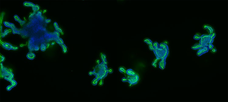 Darm-Organoide sind 3D-Gewebemodelle, die Strukturen des Darmlumens und …