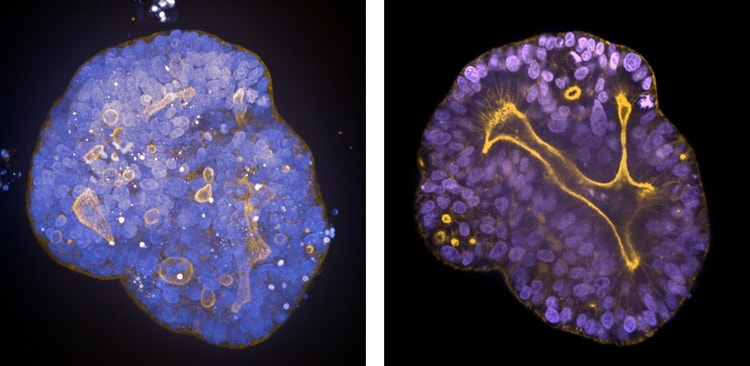 PDO Mini-Darm-Organoid-Schnitt