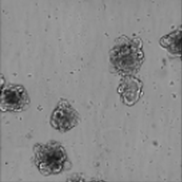 Hellfeldbild von 3D-kolorektalem Karzinom, von Patienten stammende Organoide (PDOs)