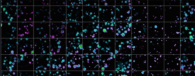 Complex Biology Workflows