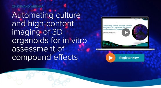 Automatisierung der Kultivierung und des High-Content-Imaging von 3D-Organoiden