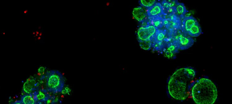 Kolorektale Organoide können verwendet werden, um Krankheiten wie entzündliche Darmerkrankungen (CED) zu untersuchen