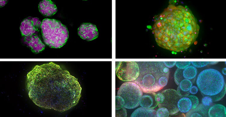 Beispiele für 3D-Zellmodelle – Sphäroide, von Patienten stammende Organoide, Nierenzellen (Herzorganoide) und Lungenorganoide