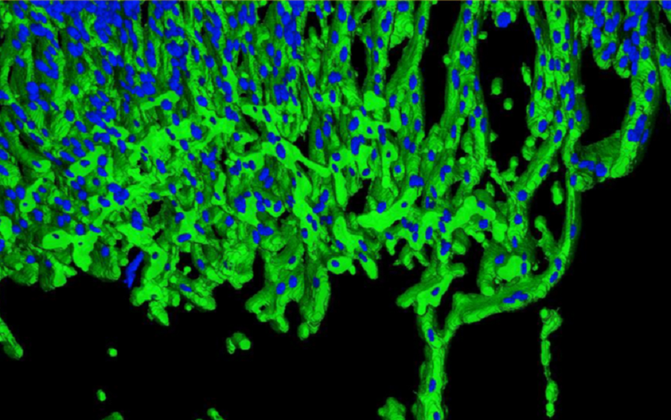 3D-Analyse angiogener Sprouts (grün) und Zellkerne (blau) mit MetaXpress