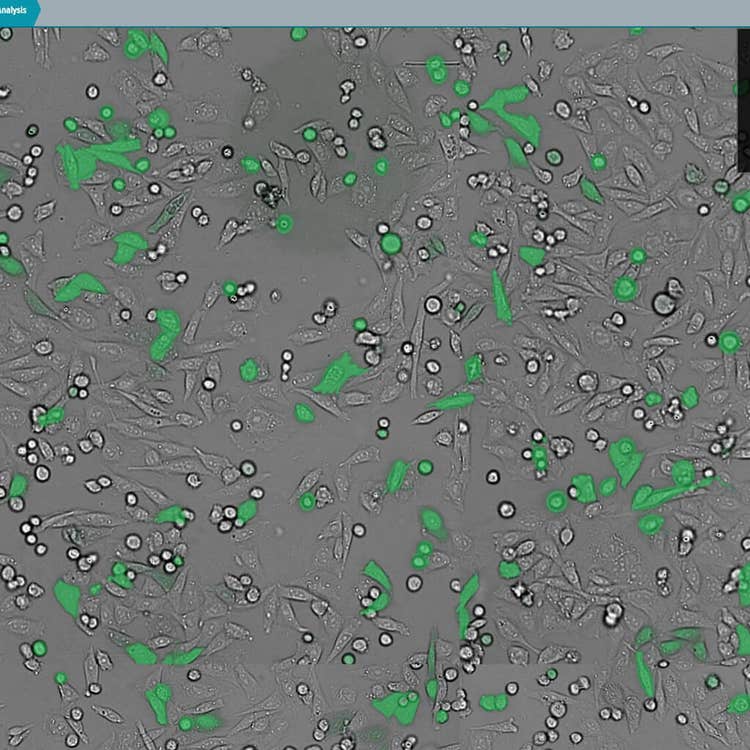 Durchlicht- und GFP-Overlay, aufgenommen mit der CellReporterXpress Software auf dem ImageXpress Nano System
