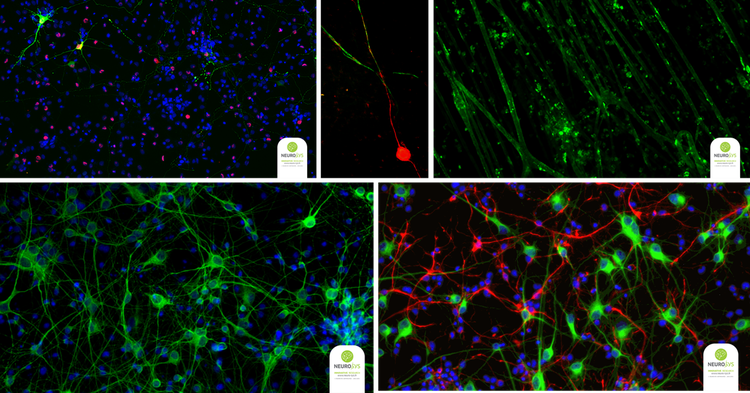 Neuromuskuläre Endplatten, Myelinisierungskinetiken und Proliferation von Gliazellen