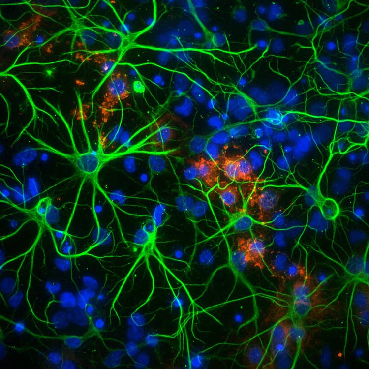 Neurone in einer 1536-Well-Platte bei 60x-Vergrößerung, aufgenommen mit dem ImageXpress Micro Confocal System