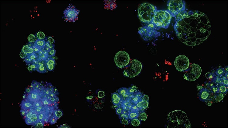 Die Zukunft der komplexen Biologie