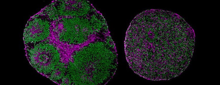 Patient-derived organoids