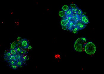 3D-Ready-Organoid