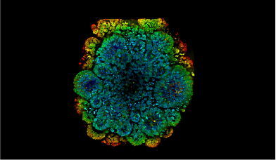 Benutzerdefinierter Organoid-Erweiterungsservice