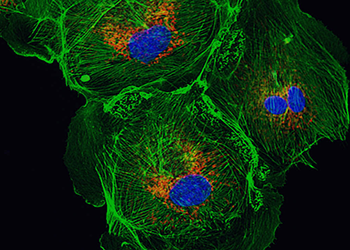 Entdeckung und Optimierung von Immunogenen