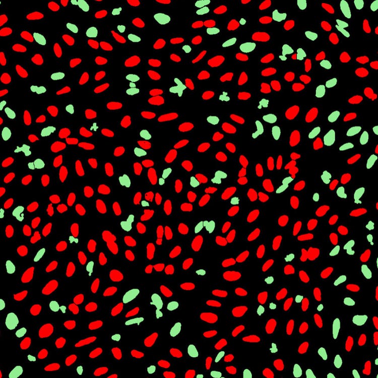 Maske für DNA-Schäden auf U2OS-Zellen, aufgenommen mit dem ImageXpress Nano System