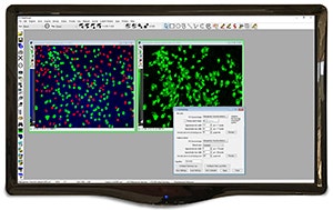 MetaMorph Software zur Mikroskopie-Automatisierung und Bildanalyse