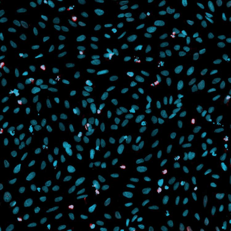 Overlay DNA-Schäden in U2OS-Zellen, aufgenommen mit dem ImageXpress Nano System