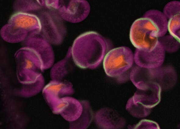 Ohne Digital Confocal