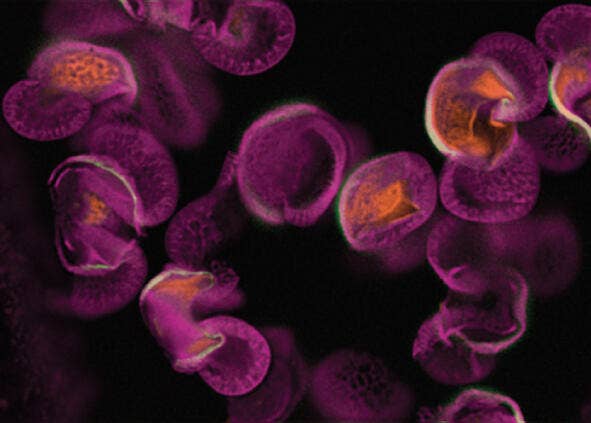 Mit Digital Confocal