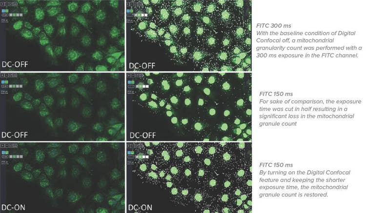 FITC Channel – Das ImageXpress Pico Digital Confocal nutzt die AutoQuant 2D Real Time Deconvolution